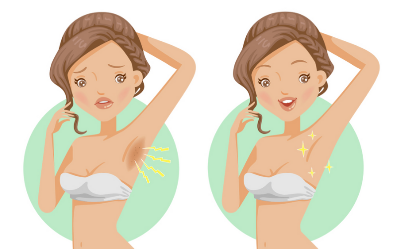 Cách sử dụng kem trị thâm nách