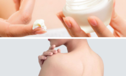 Lựa chọn kem trị mụn lưng có thành phần hỗ trợ cấp ẩm giúp cho làn da mịn màng