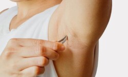 Nhổ lông nách bằng nhíp có thể gây mùi hôi khó chịu
