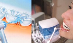 Tại sao phải sử dụng máy tăm nước